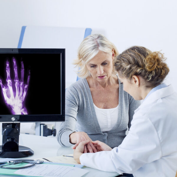 10 Symptoms of Rheumatoid Arthritis: Early Signs and Indicators