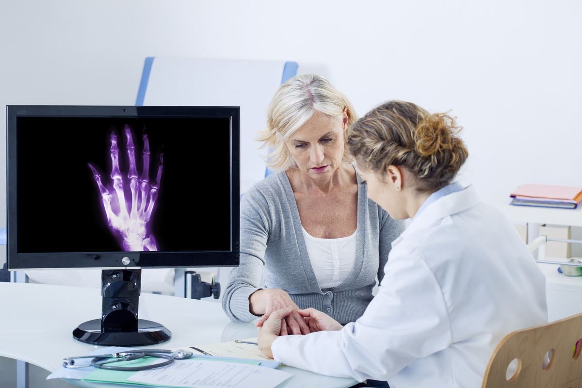 10 Symptoms of Rheumatoid Arthritis: Early Signs and Indicators