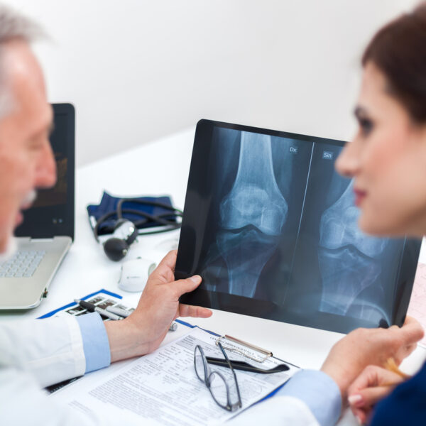 Exploring the Safest Osteoporosis Treatments: A Comprehensive Guide