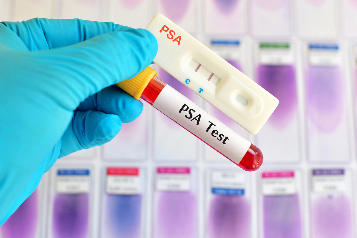 Understanding High PSA Levels: A Comprehensive Chart by Age