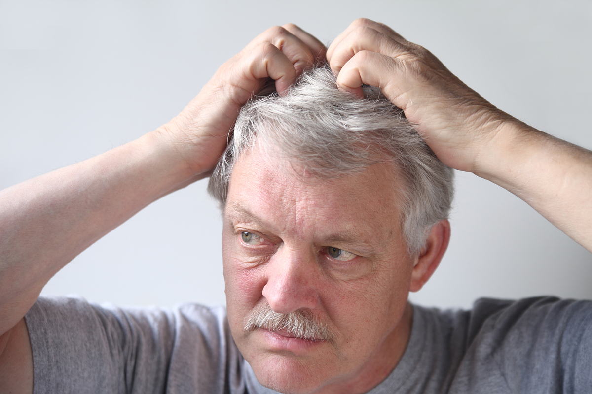 Understanding Plaque Psoriasis on the Scalp: Symptoms, Causes, and Treatment Options